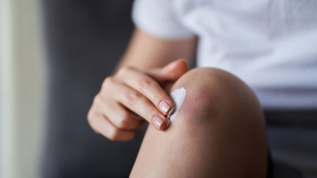 Person applying white cream to the skin on their knee.